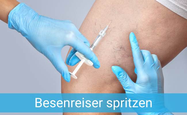 Besenreiser spritzen