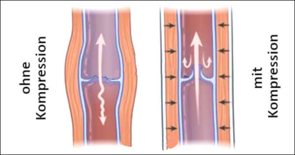 Blutfluss in den Venen mit und ohne Kompression